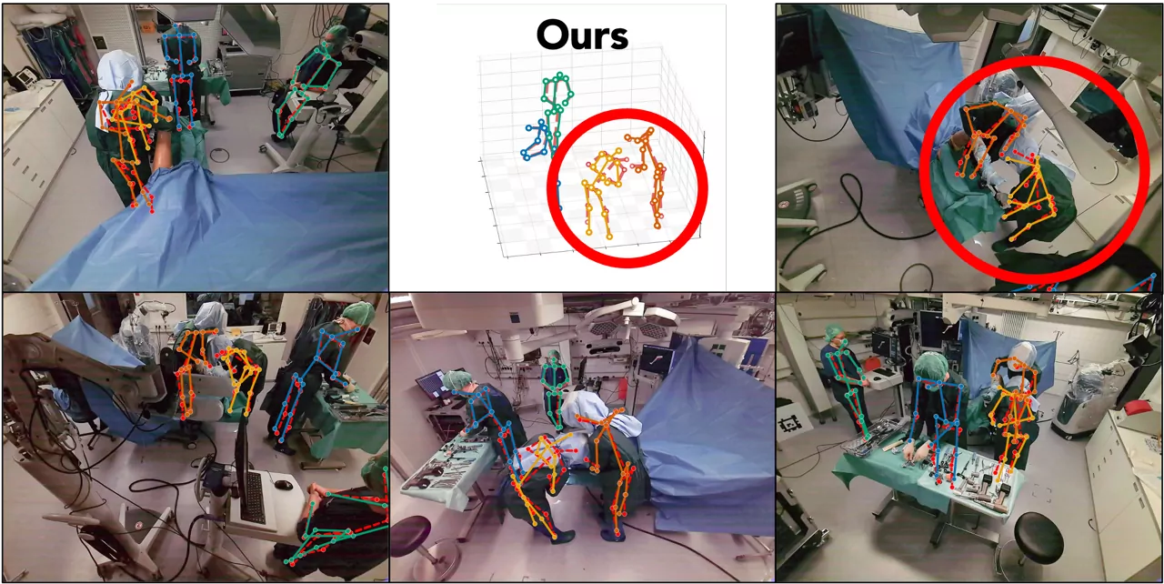 DisPOSE on MM-OR Pose: recovers both surgeons under occlusion.