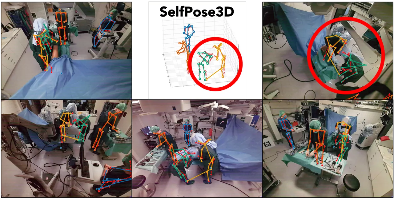 SelfPose3D on MM-OR Pose: fails on the bending surgeon.