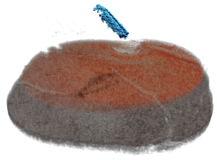 Context-Aware Real-Time Semantic View Expansion of Intraoperative 4D OCT